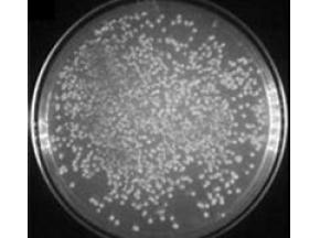 global, Agrobacterium tumefaciens Competent Cells, market report, history and forecast, 2013-2025.jpg