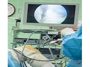 Global Surgical Imaging Display Market to Witness a Pronounce Growth During 2025 - QY research